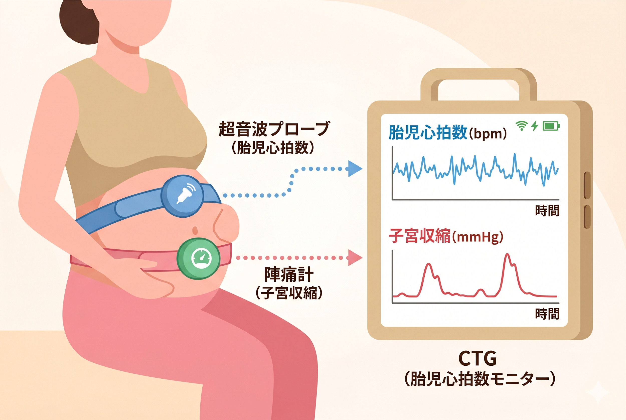 CTG（分娩監視装置）の仕組み